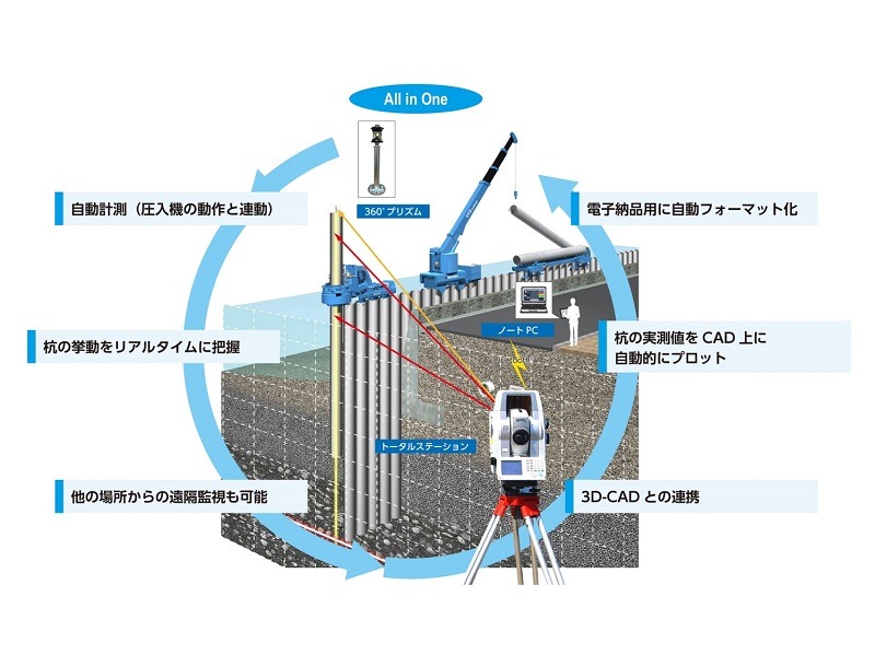 インプラントNAVIの詳細